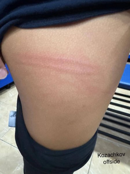 Ударили 12-летнюю спортсменку палкой в Актау: скандал прокомментировали в федерации художественной и эстетической гимнастики
