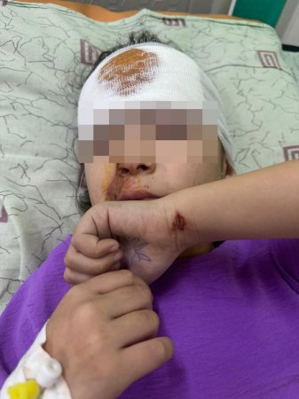 Семилетнюю девочку автомобиль сбил в одном из сёл Мангистау 