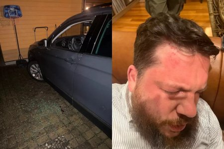 "Ударил раз 15": на соратника Навального напали с молотком прямо у его дома